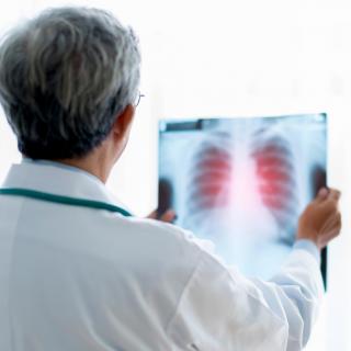  Exames pulmonares em Sorocaba