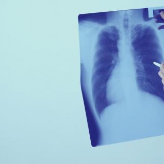  Tratamento de doenças respiratórias em Sorocaba