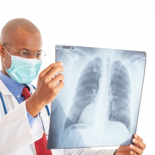 Médico de Tuberculose Tratamento de doenças respiratórias em Sorocaba Médico de Tuberculose Exames pulmonares em Sorocaba